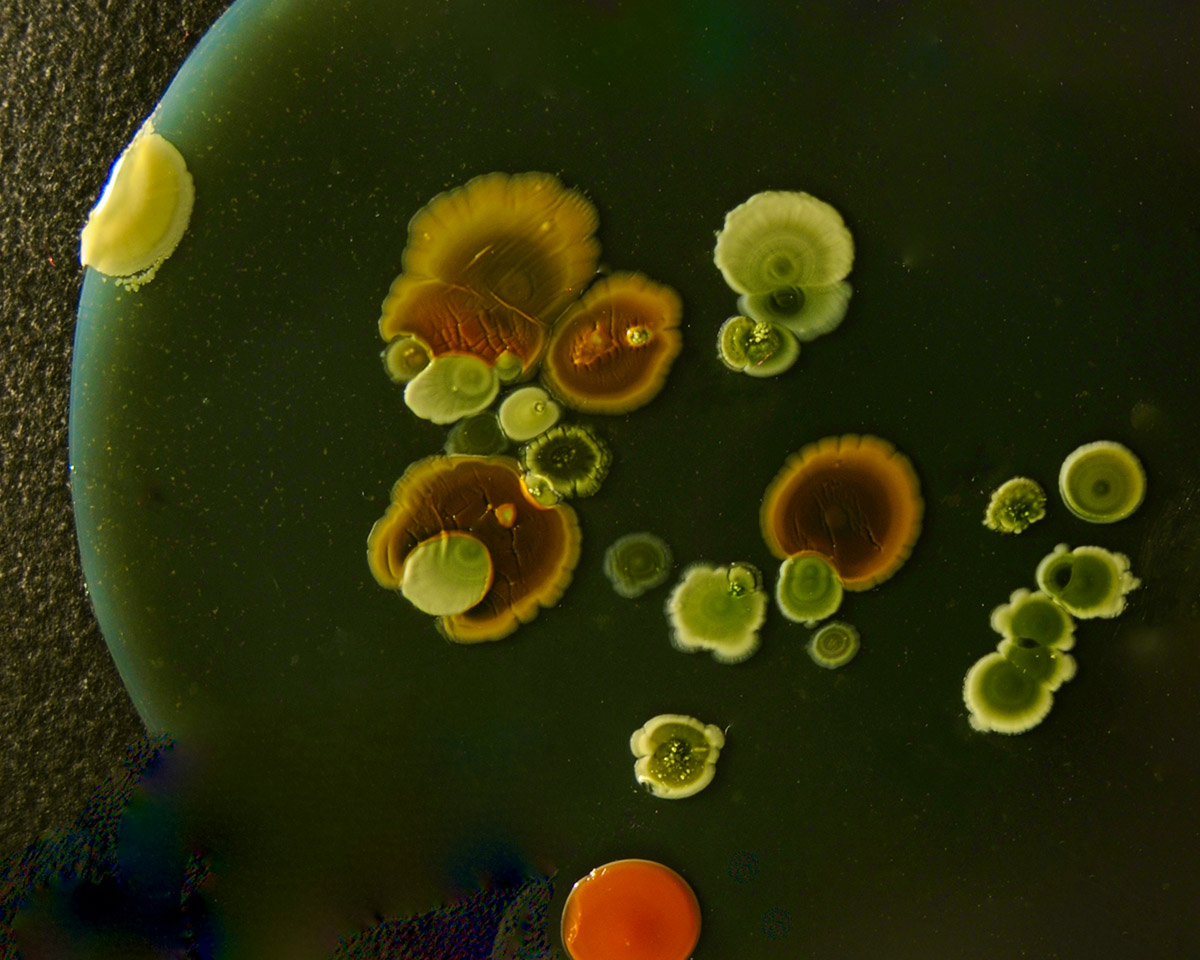 Batteri per le piante: cosa cambia con i biostimolanti microbici